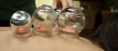 cupping