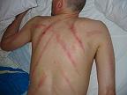 Gua Sha