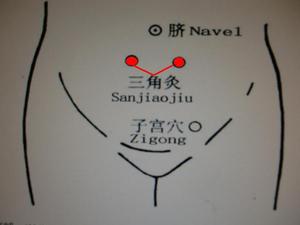 Sanjiaojiu