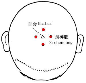 Sishencong