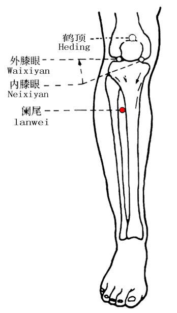 Lanwei